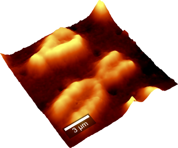 人染色体のAFM画像